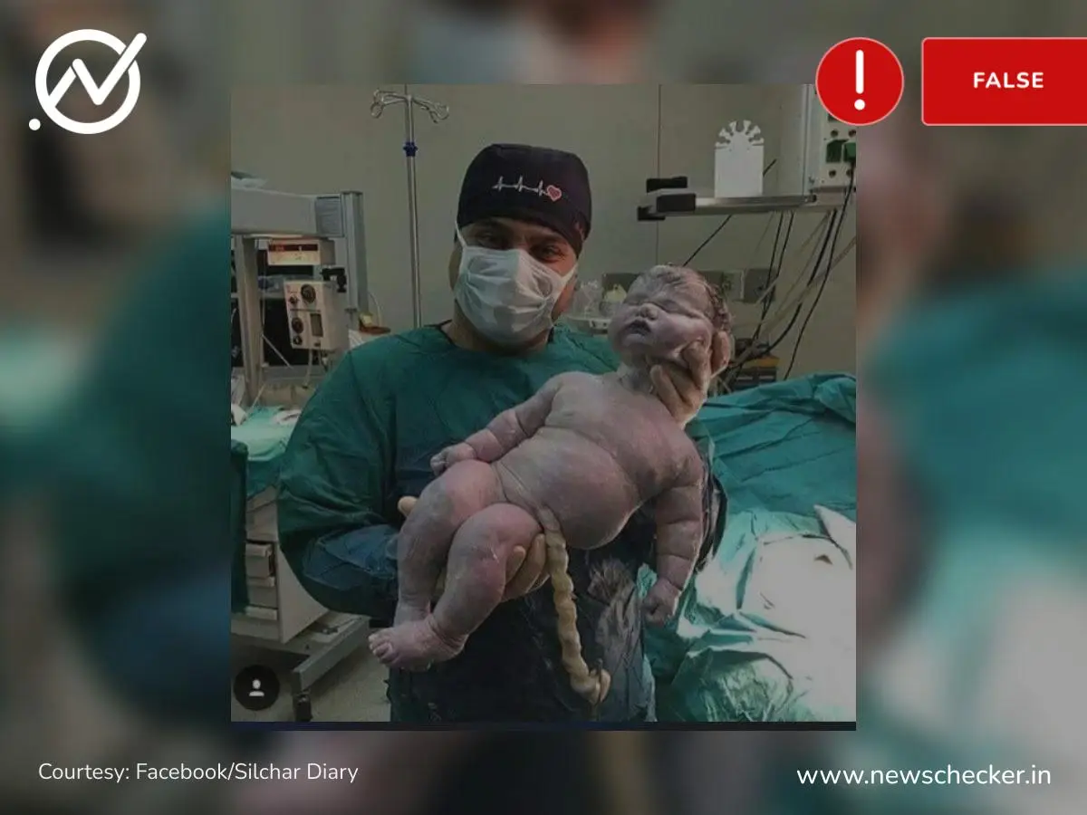 World s heaviest baby born at 8 6kg here s the truth behind viral
