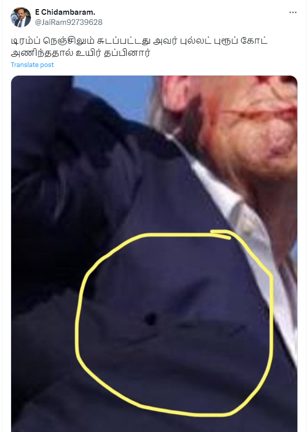 டிரம்ப் நெஞ்சில் துப்பாக்கி குண்டு பாய்ந்தது.