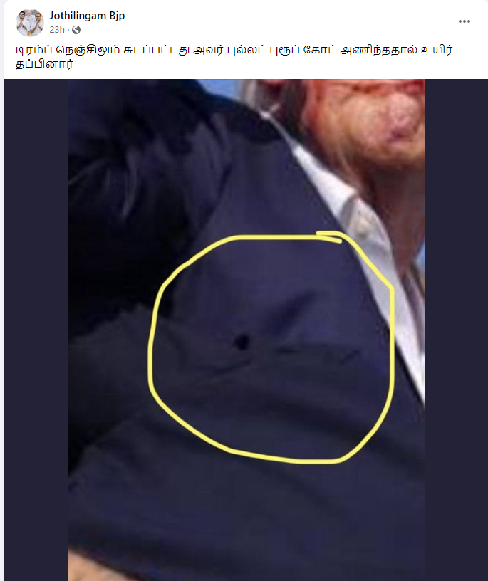 டிரம்ப் நெஞ்சில் துப்பாக்கி குண்டு பாய்ந்தது.