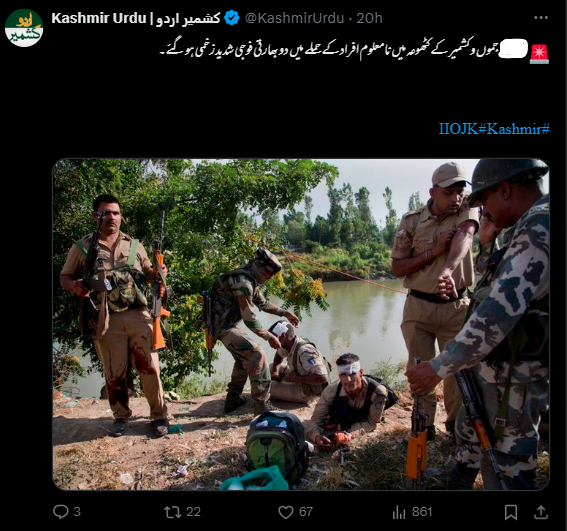 یہ تصویر کٹھوعہ میں عسکریت پسندوں کے حالیہ حملے میں زخمی ہونے والے فوجی جوانوں کی نہیں ہے۔