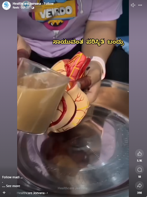 ಖಾಲಿ ಹೊಟ್ಟೆಯಲ್ಲಿ ಬಿಸಿ ಚಹಾ ಕುಡಿದರೆ ಯಕೃತ್ತಿಗೆ ಹಾನಿ, ಆಸಿಡಿಟಿ ಹೆಚ್ಚಾಗುತ್ತಾ?