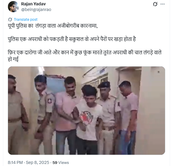 यूपी पुलिस के कहने पर लंगड़ाकर चलने